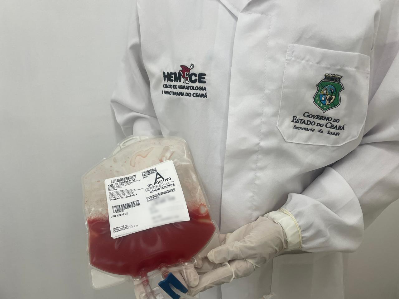 Hemoce alcança marca de mil coletas de medula óssea para transplantes realizados pelo SUS no Ceará